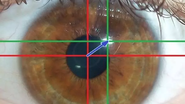 Image of eye tracking software in action